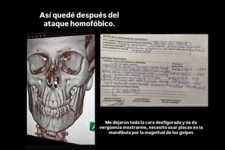 Brutal golpiza a un joven gay en Palermo